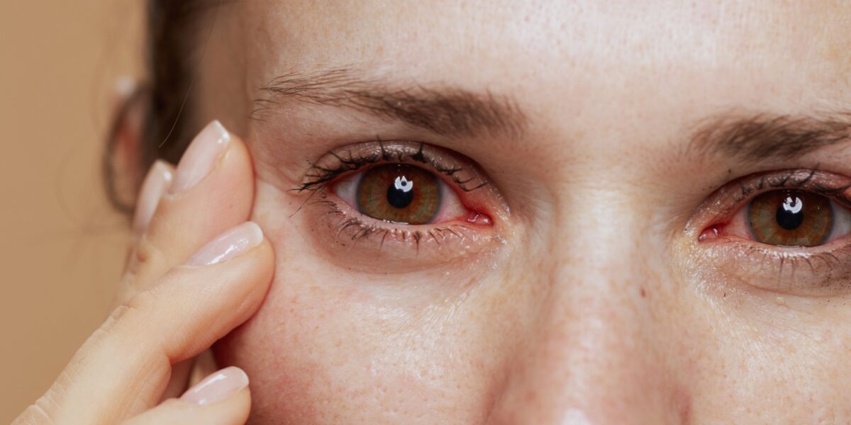 Dry-Eyes-Common-Causes-And-Treatments-Hero