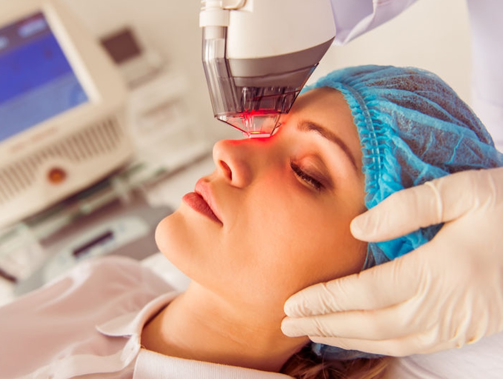 IPL-for-dry-eye-